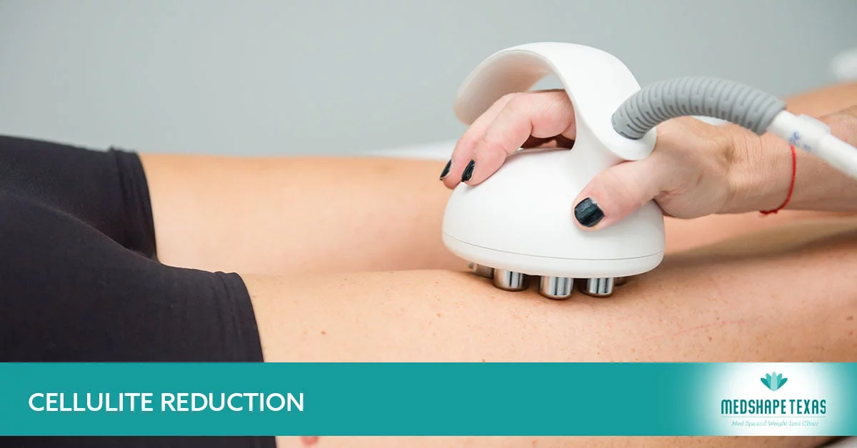 Pasadena, TX's Top Cellulite Reduction Treatment – Medshape Texas