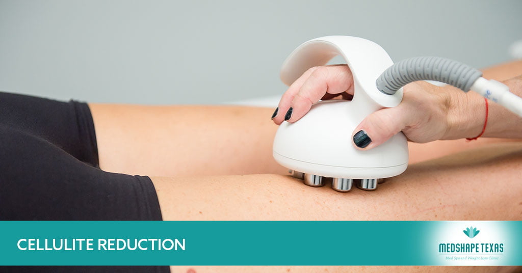 Pasadena, TX's Top Cellulite Reduction Treatment – Medshape Texas