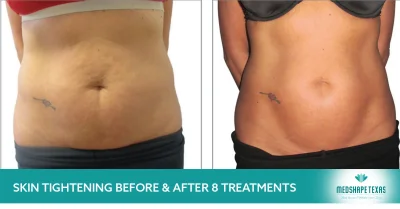semaglutide weight loss clear lake Worth Top Clear Lake, TX Medspa