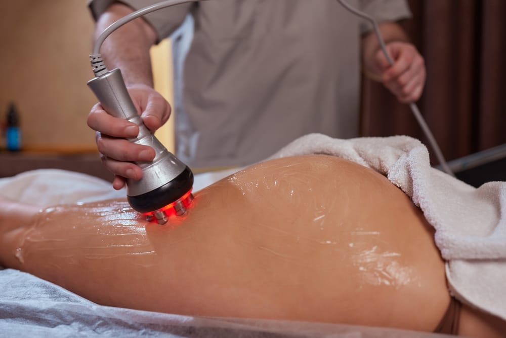 Medspa cellulite reduction in Pasadena, TX.